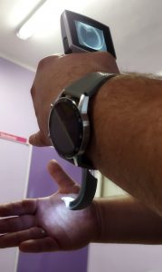 A videolaryngoszkóp segíti a gégebemenet feltárását